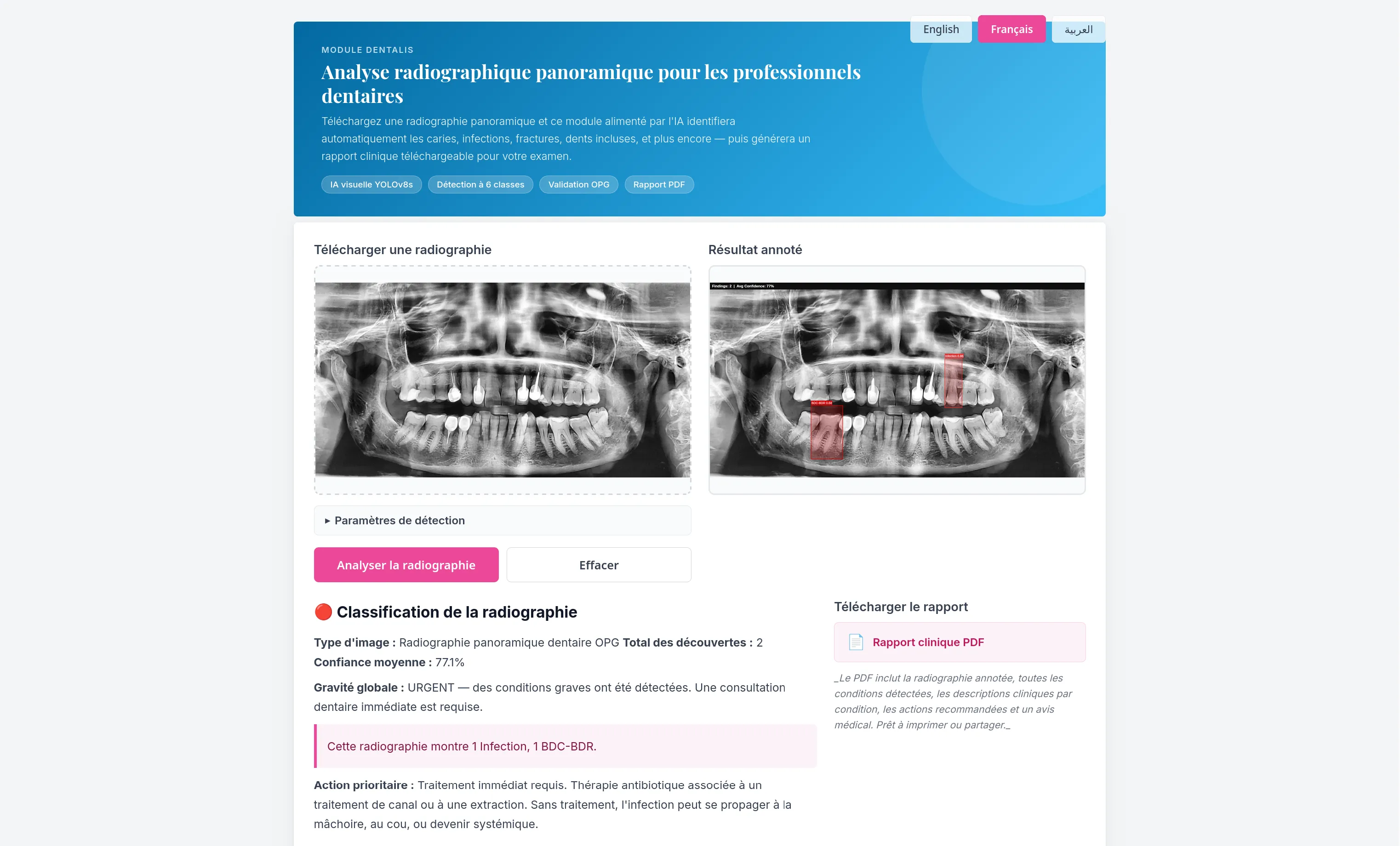 Xray Smart Analyzer